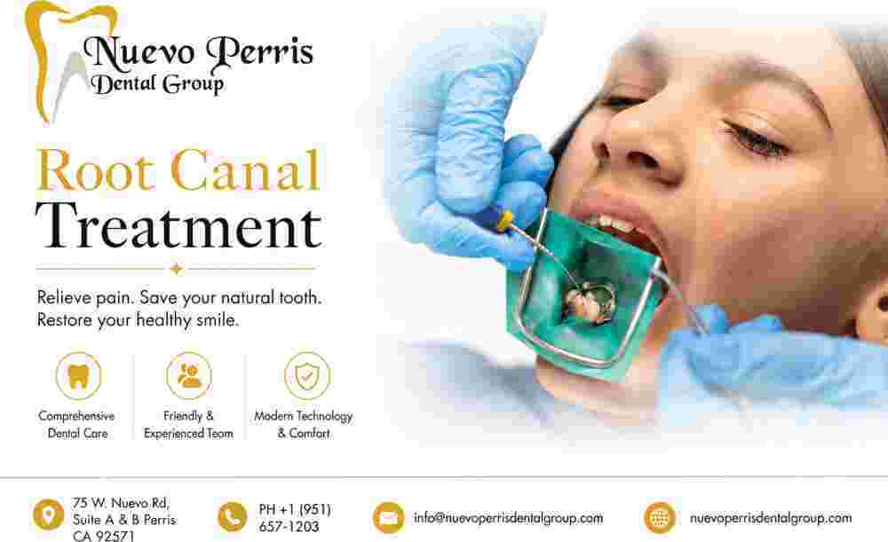 root-canal-treatment-perris-compassionate-dental-care-big-0