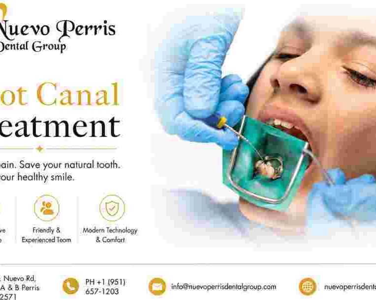 root-canal-treatment-perris-compassionate-dental-care