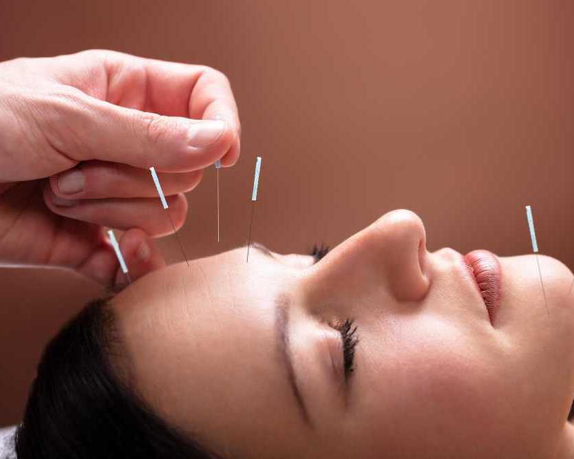 experienced-acupuncturist-serving-hollywood-fl