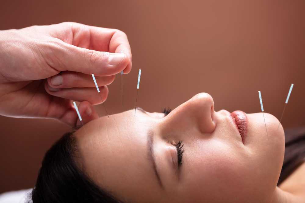 experienced-acupuncturist-serving-hollywood-fl-big-0
