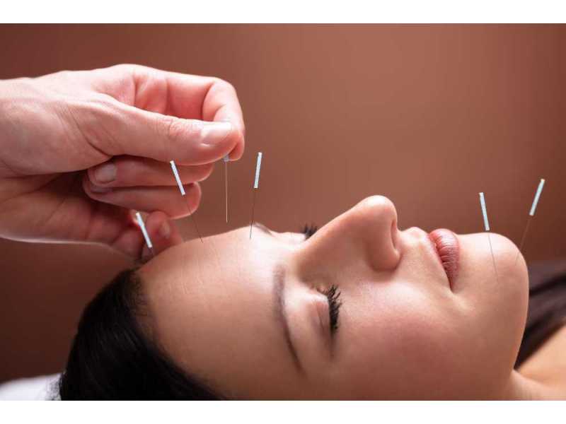 experienced-acupuncturist-serving-hollywood-fl-small-0