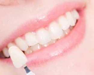 protect-damaged-teeth-with-durable-crowns