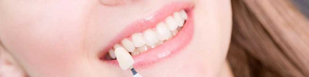 protect-damaged-teeth-with-durable-crowns-big-0