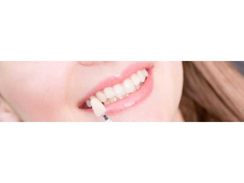 protect-damaged-teeth-with-durable-crowns-small-0