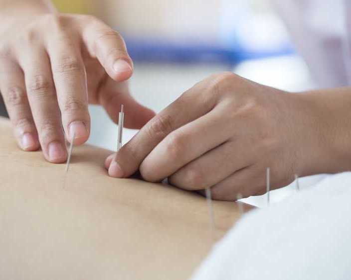 pelvic-floor-acupuncture-in-midtown