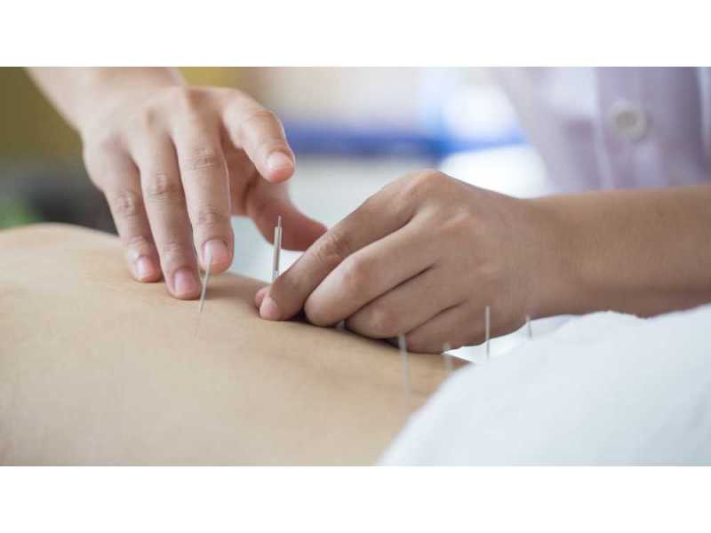 pelvic-floor-acupuncture-in-midtown-small-0