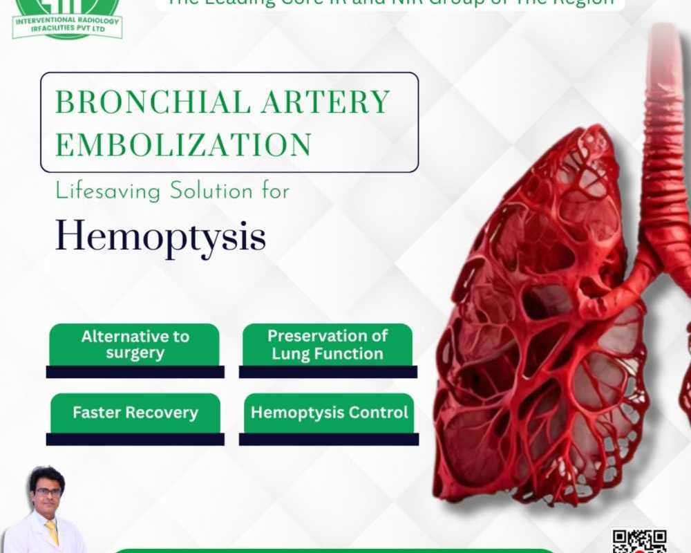 bronchial-artery-embolization-effective-treatment-of-hemoptysis