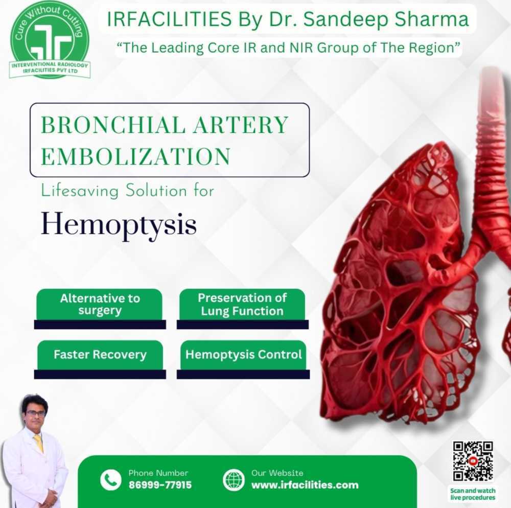 bronchial-artery-embolization-effective-treatment-of-hemoptysis-big-0