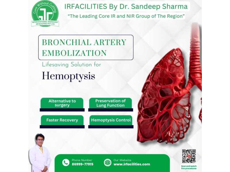 bronchial-artery-embolization-effective-treatment-of-hemoptysis-small-0