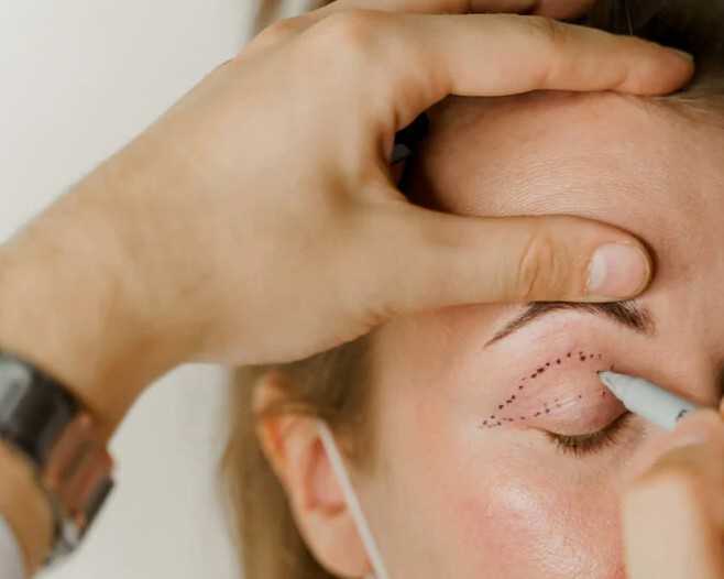 droopy-eyelid-repair-ptosis-treatment-services-in-fairfax-virginia