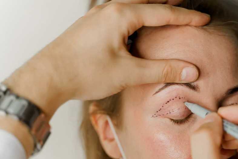 droopy-eyelid-repair-ptosis-treatment-services-in-fairfax-virginia-big-0