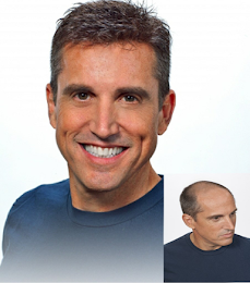 transform-hair-thinning-into-fuller-healthier-hair-big-0