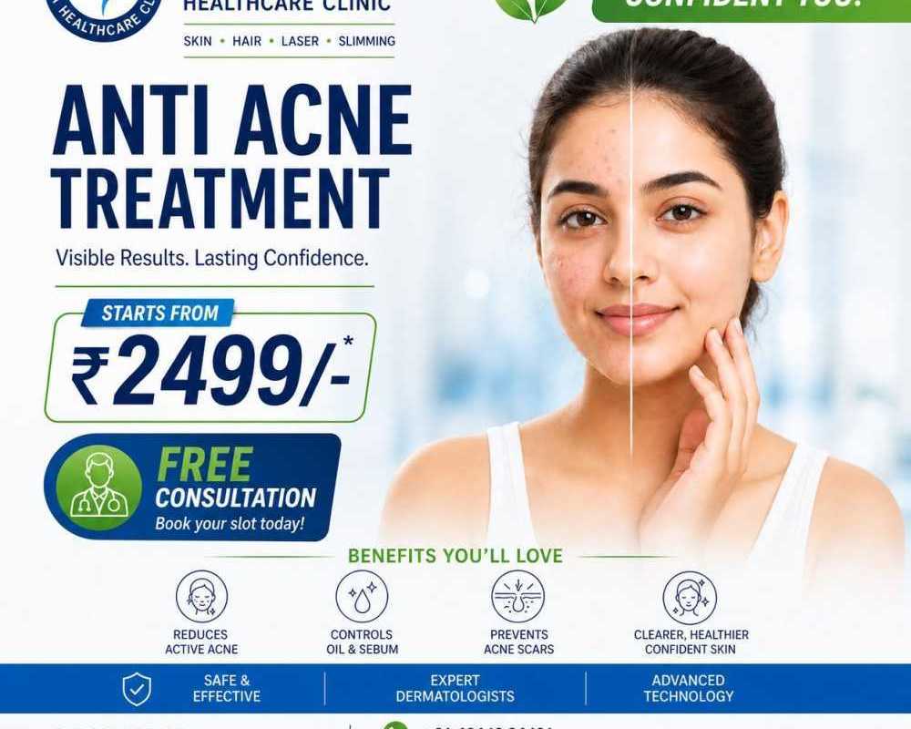 anti-acne-treatment-in-bangalore-with-diva-healthcare-clinic