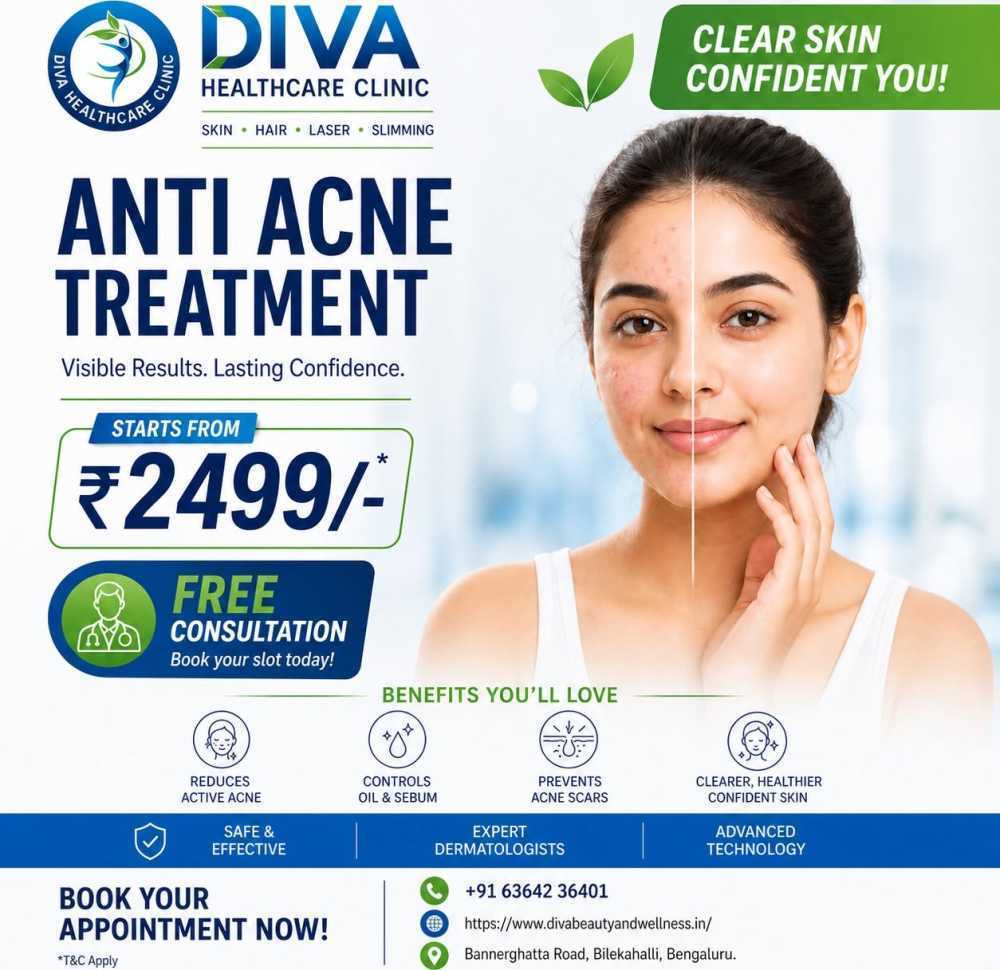 anti-acne-treatment-in-bangalore-with-diva-healthcare-clinic-big-0