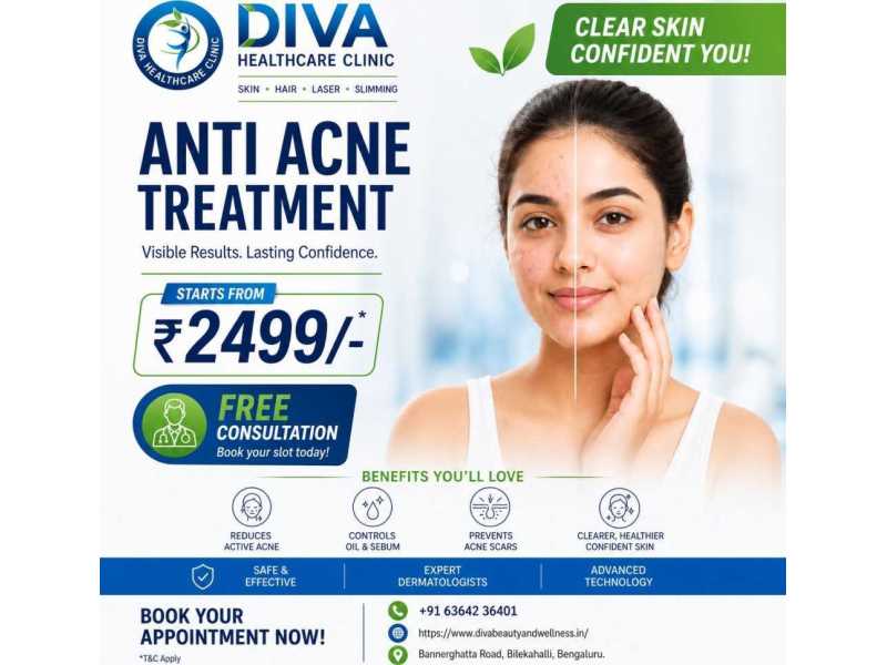 anti-acne-treatment-in-bangalore-with-diva-healthcare-clinic-small-0
