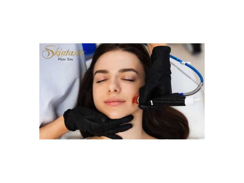 top-hydrafacial-in-riverside-for-glowing-and-healthy-skin-small-0