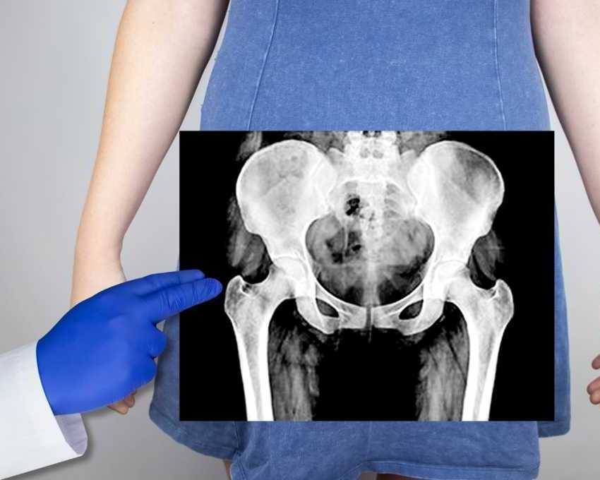pelvic-floor-acupuncture-nyc