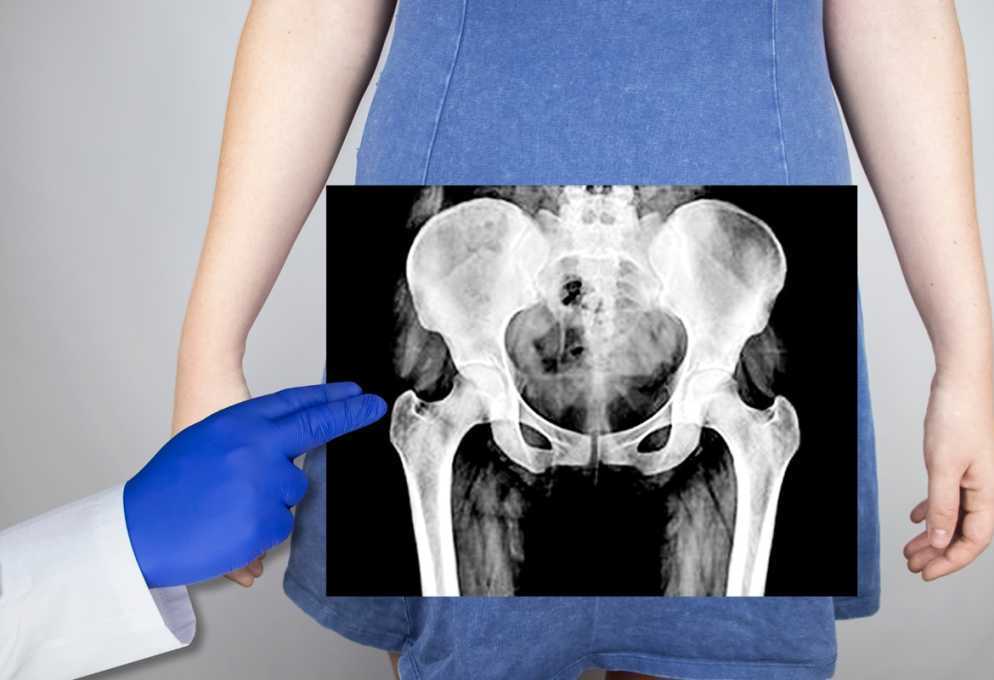 pelvic-floor-acupuncture-nyc-big-0