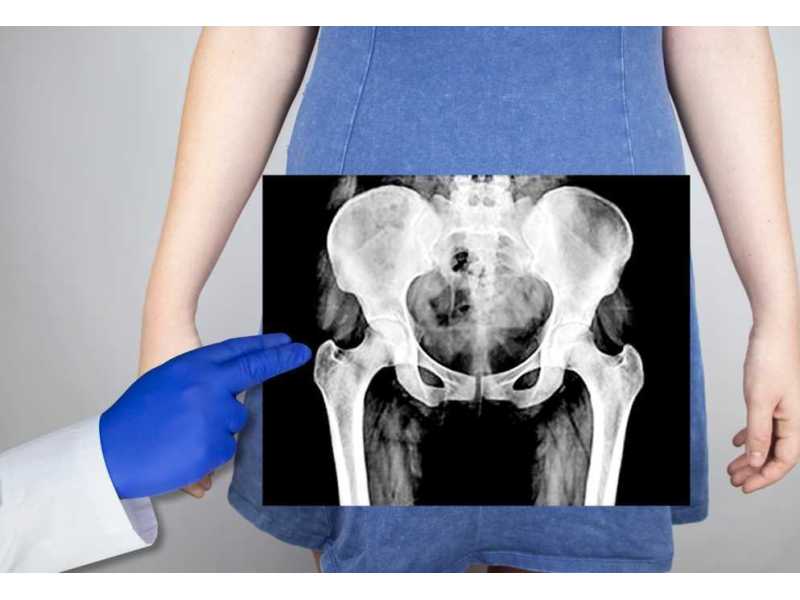 pelvic-floor-acupuncture-nyc-small-0