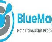 hair-implants-turkey-bluemagic-groups-trusted-expertise