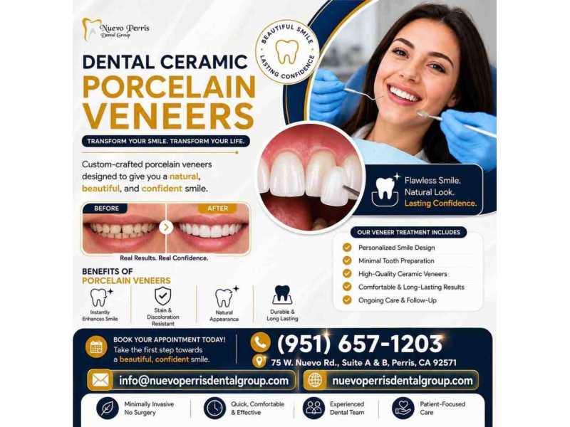dental-ceramic-porcelain-veneers-california-dr-tejas-modi-small-0