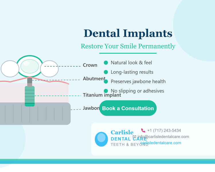 affordable-dental-implant-in-carlisle-pa-carlisle-dental-care
