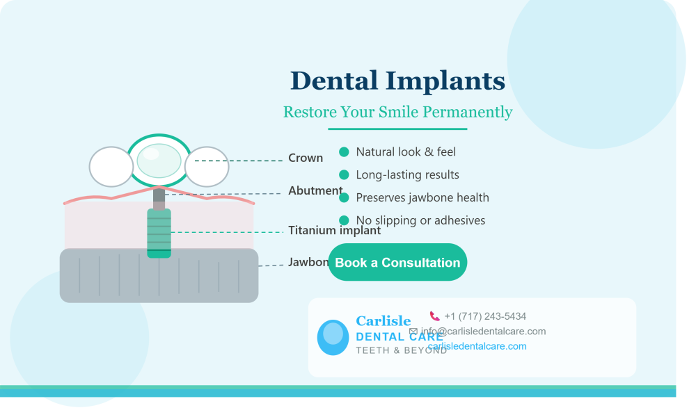affordable-dental-implant-in-carlisle-pa-carlisle-dental-care-big-0