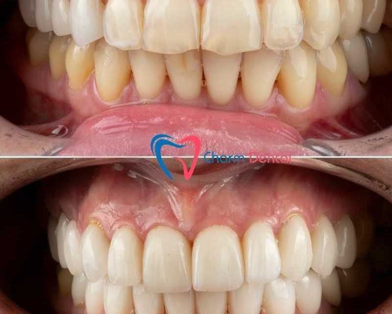 dental-office-near-humble-trusted-family-dental-care-in-humble-tx
