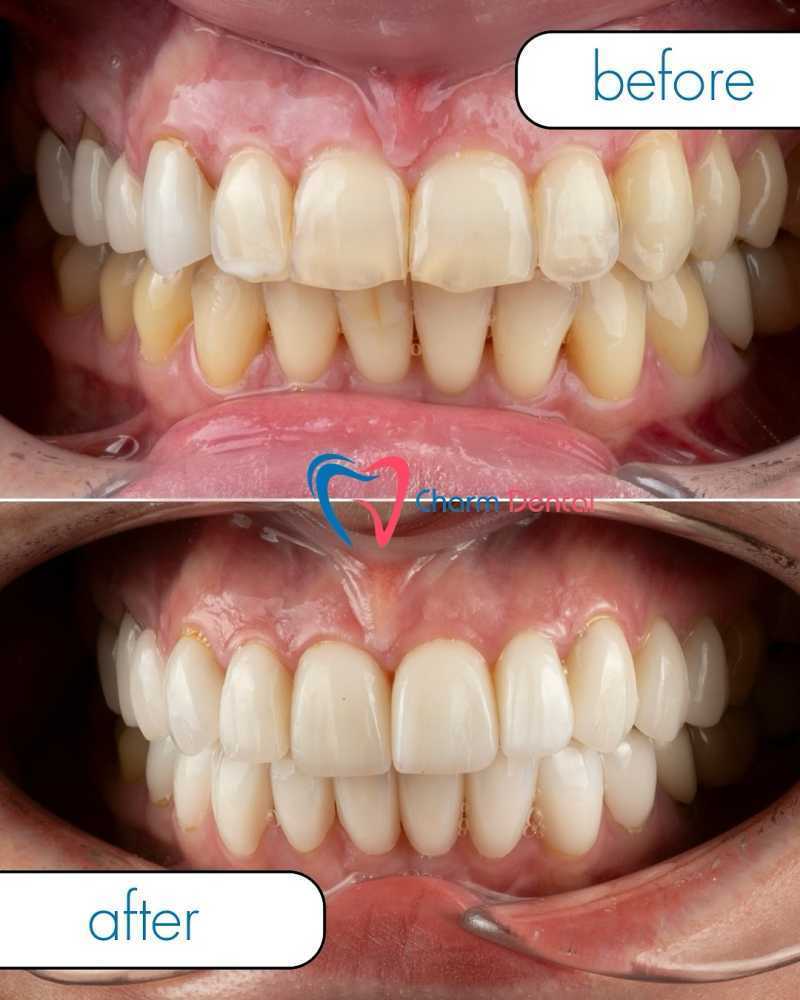 dental-office-near-humble-trusted-family-dental-care-in-humble-tx-big-0