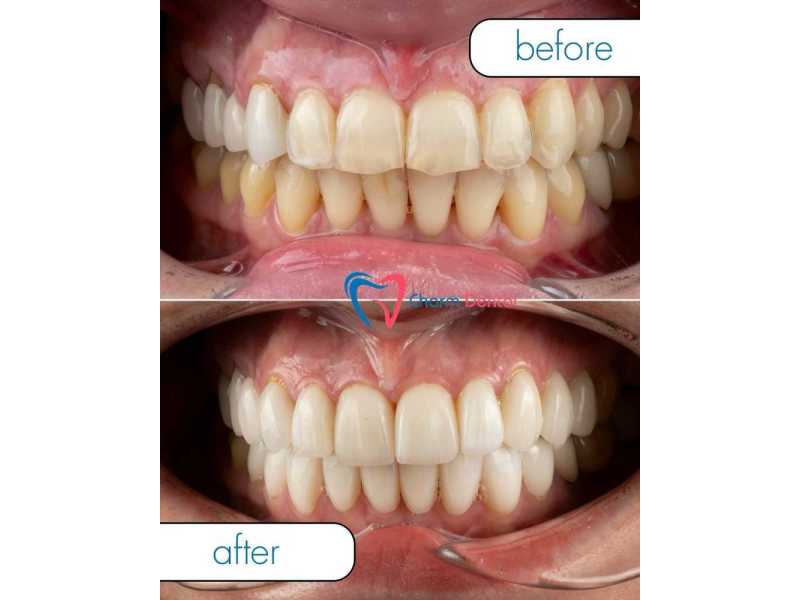 dental-office-near-humble-trusted-family-dental-care-in-humble-tx-small-0