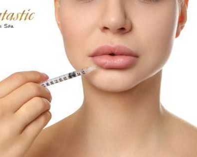 premium-lip-fillers-riverside-for-smooth-lip-volume