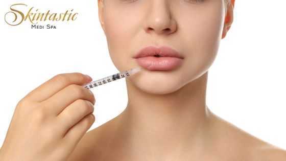 premium-lip-fillers-riverside-for-smooth-lip-volume-big-0