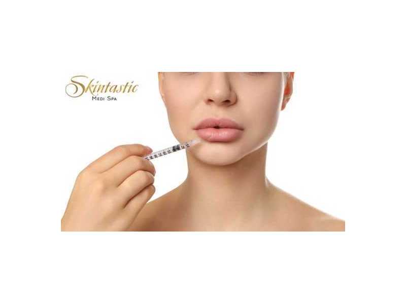 premium-lip-fillers-riverside-for-smooth-lip-volume-small-0