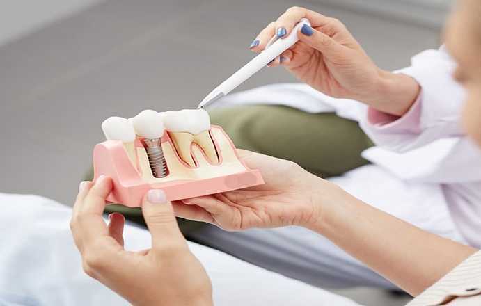 smile-again-with-houstons-trusted-dental-implant-experts-big-0
