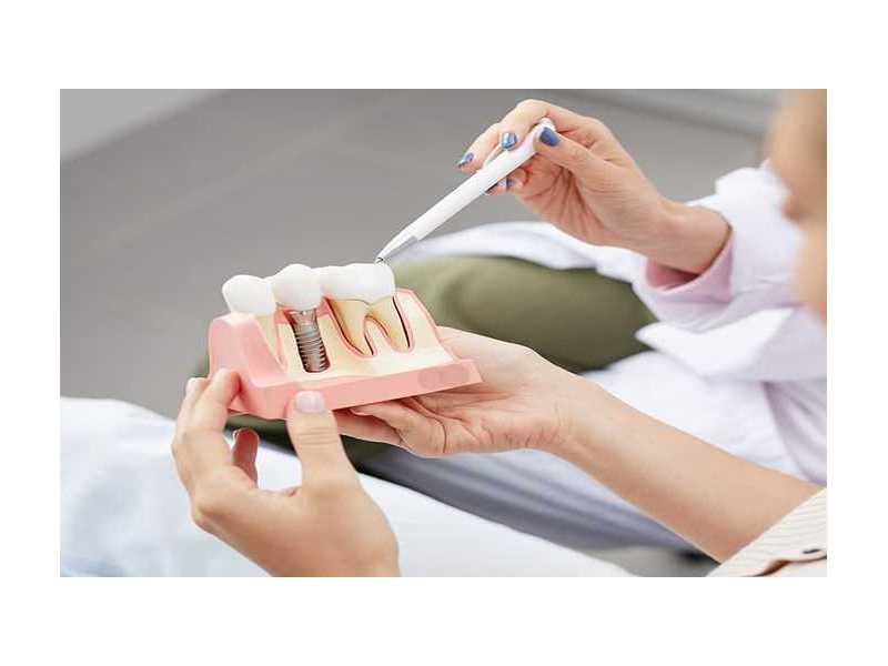 smile-again-with-houstons-trusted-dental-implant-experts-small-0