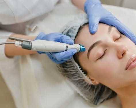 rf-microneedling-benefits-for-reducing-fine-lines-and-wrinkles