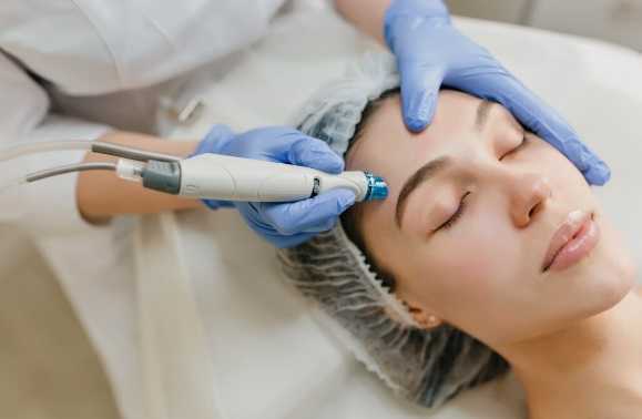 rf-microneedling-benefits-for-reducing-fine-lines-and-wrinkles-big-0