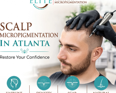 restore-your-hairline-with-expert-scalp-treatments