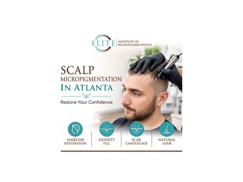 restore-your-hairline-with-expert-scalp-treatments-small-0