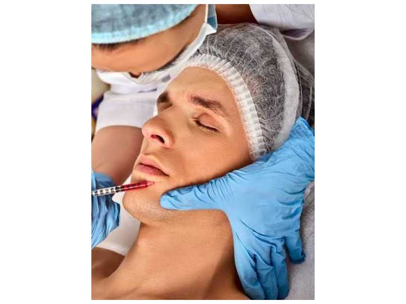 chin-implant-and-reduction-surgery-in-pasadena-texas-small-0