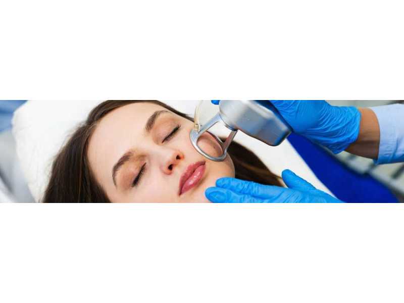 co2-laser-resurfacing-treatment-in-west-palm-beach-florida-small-0