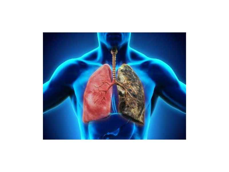 treatment-for-lung-cancer-stage-4-small-0
