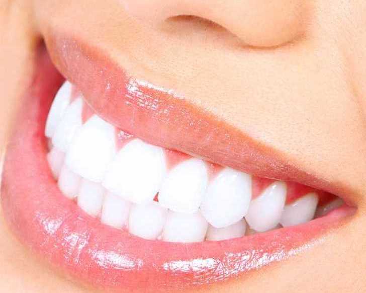 professional-teeth-whitening-in-san-antonio-tx-primo-dental