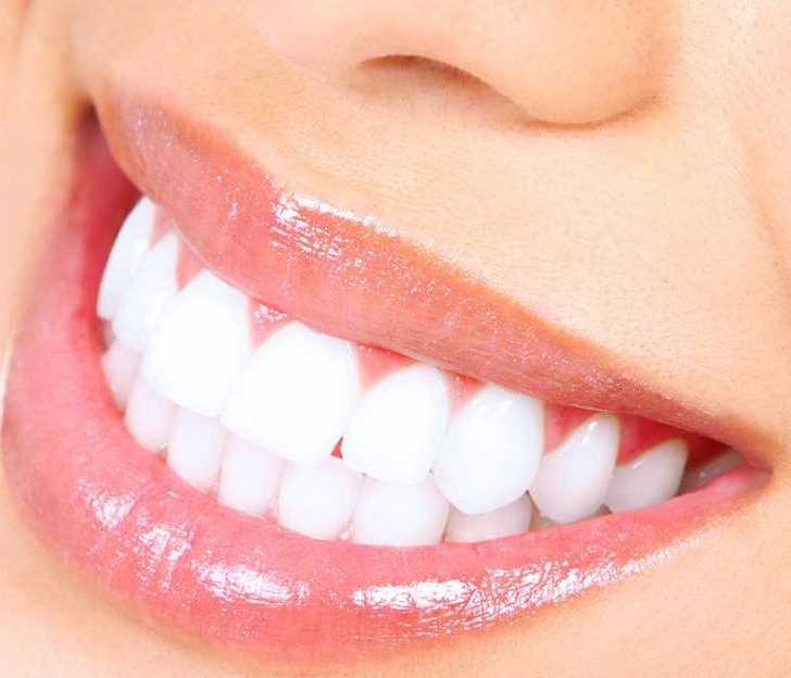 professional-teeth-whitening-in-san-antonio-tx-primo-dental-big-0