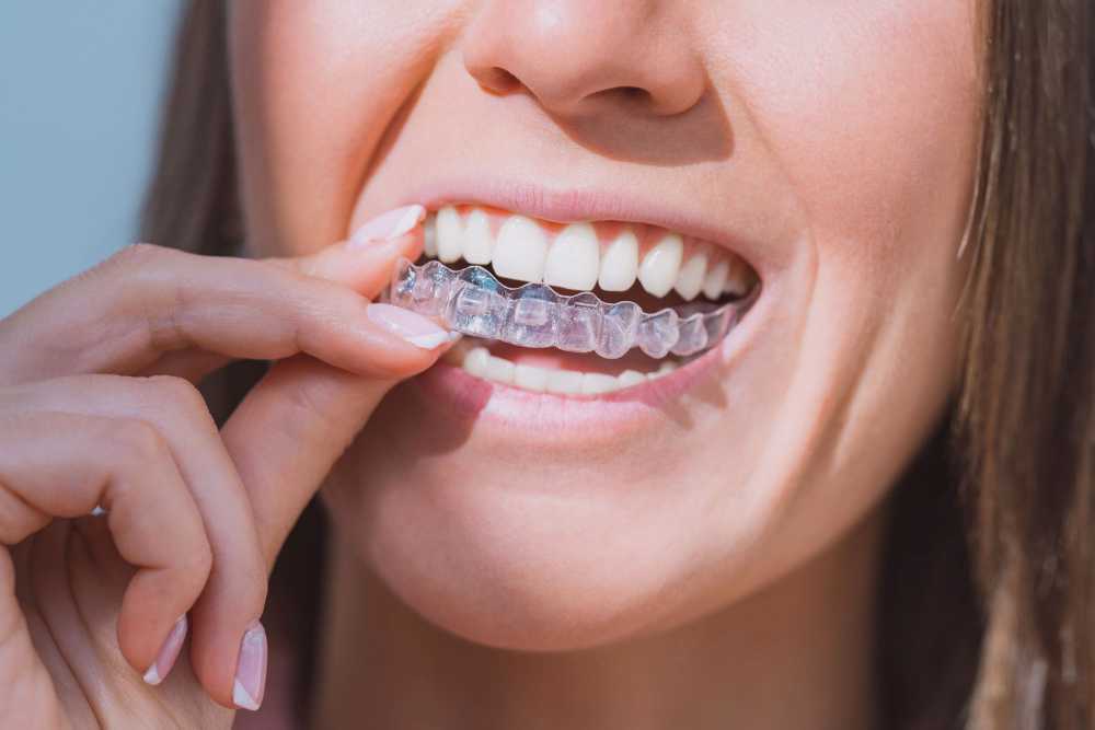 transform-your-smile-discreetly-with-clear-aligners-in-league-city-big-0