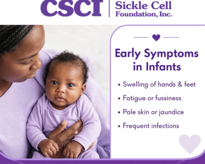 early-sickle-cell-signs-every-parent-must-know