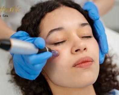 best-potenza-microneedling-near-me-in-riverside
