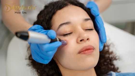best-potenza-microneedling-near-me-in-riverside-big-0