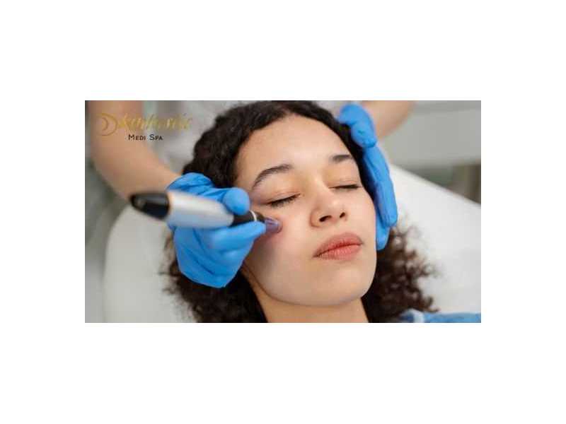 best-potenza-microneedling-near-me-in-riverside-small-0