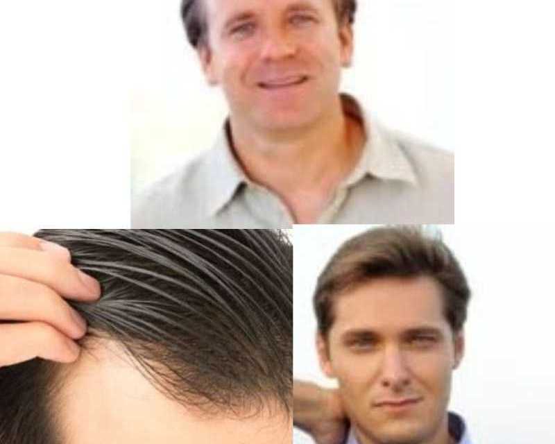 premium-edge-light-hairpieces-for-a-natural-appearance